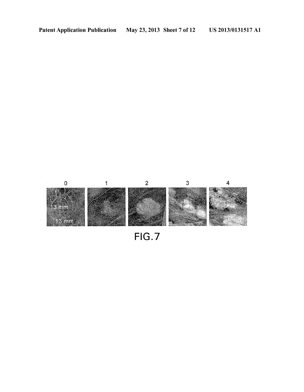 MEDICAL HYPERSPECTRAL IMAGING FOR EVALUATION OF TISSUE AND TUMOR - diagram, schematic, and image 08