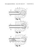 ROTATING FULL-CORE BIOPSY NEEDLE diagram and image