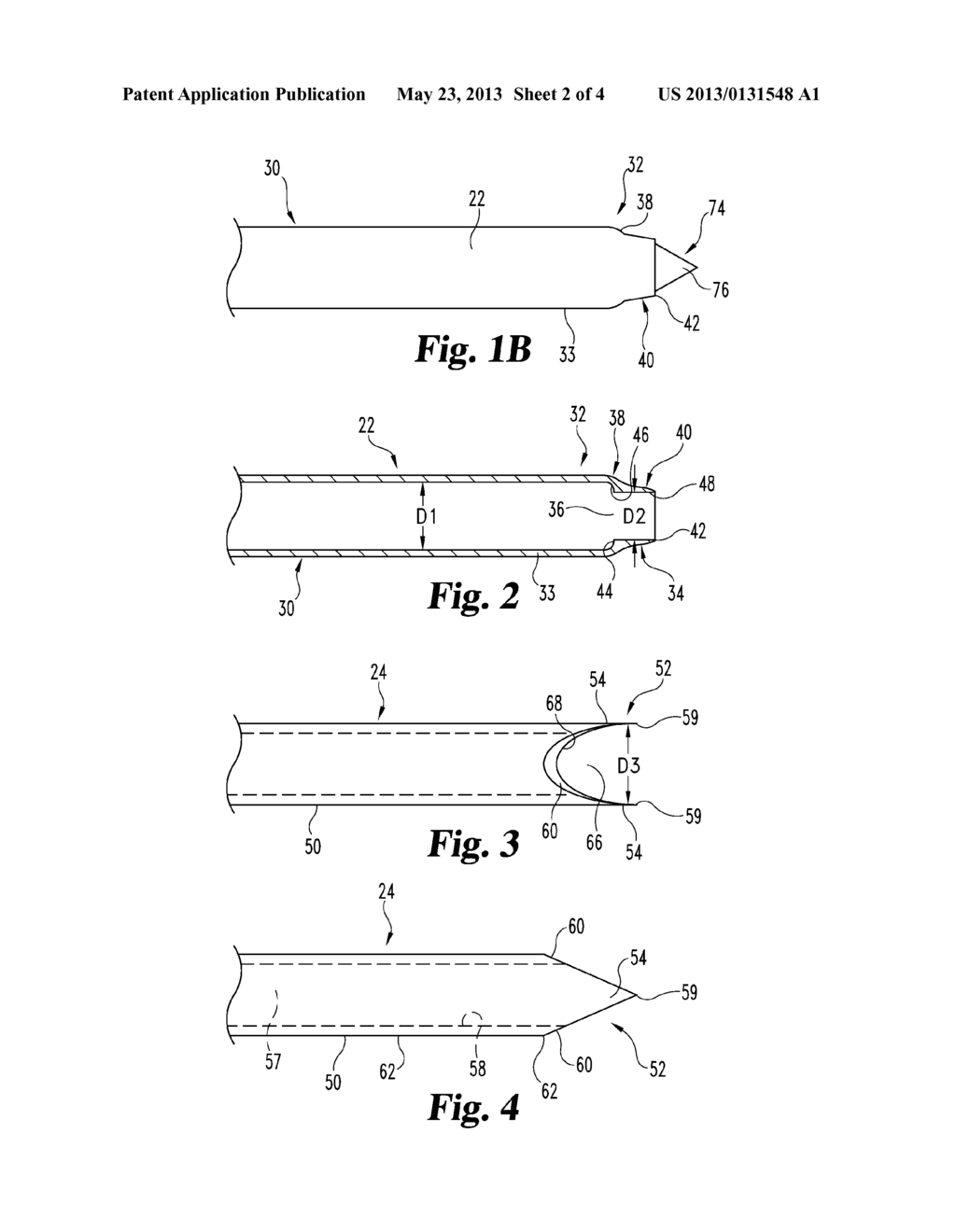 COAXIAL INCISIONAL FULL-CORE BIOPSY NEEDLE - diagram, schematic, and image 03