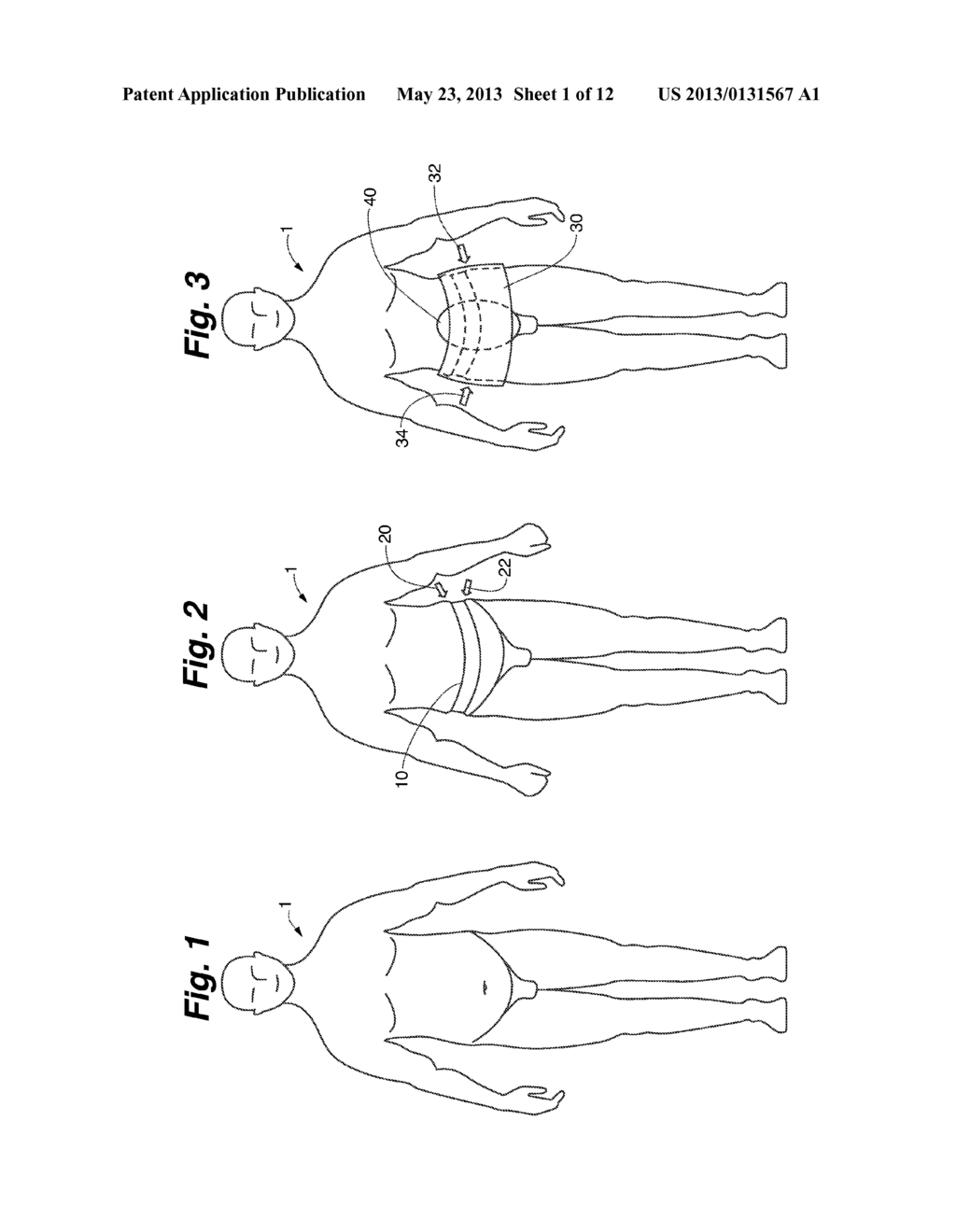 BACK BRACE SYSTEM - diagram, schematic, and image 02