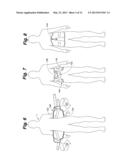 BACK BRACE SYSTEM diagram and image