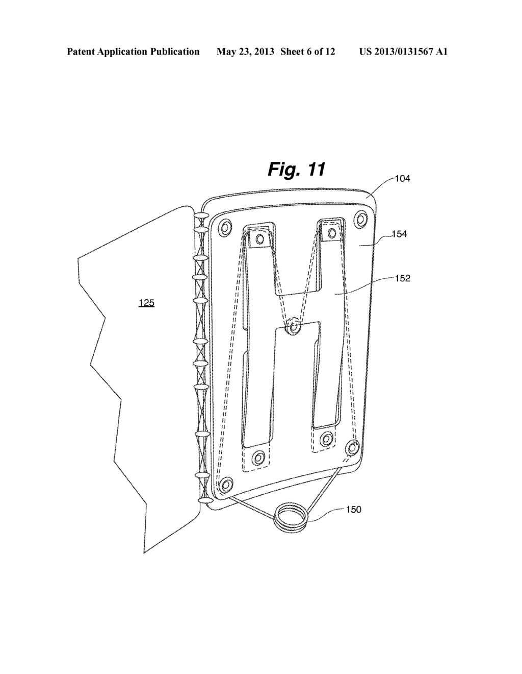 BACK BRACE SYSTEM - diagram, schematic, and image 07