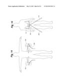 BACK BRACE SYSTEM diagram and image