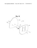 BACK BRACE SYSTEM diagram and image