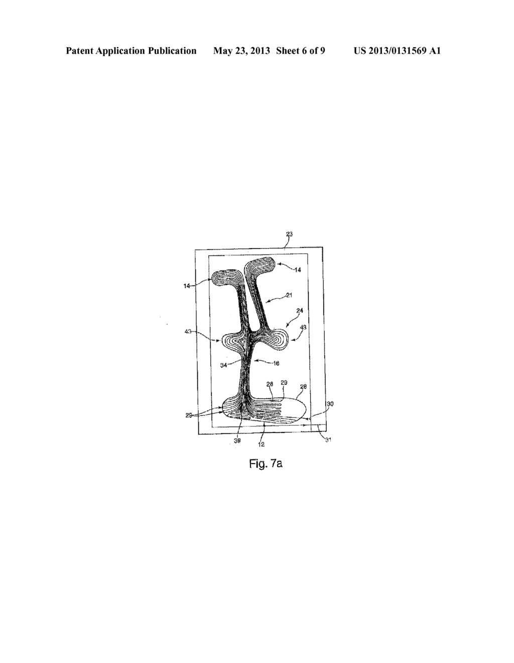 ORTHOSIS AND PRODUCTION METHOD - diagram, schematic, and image 07