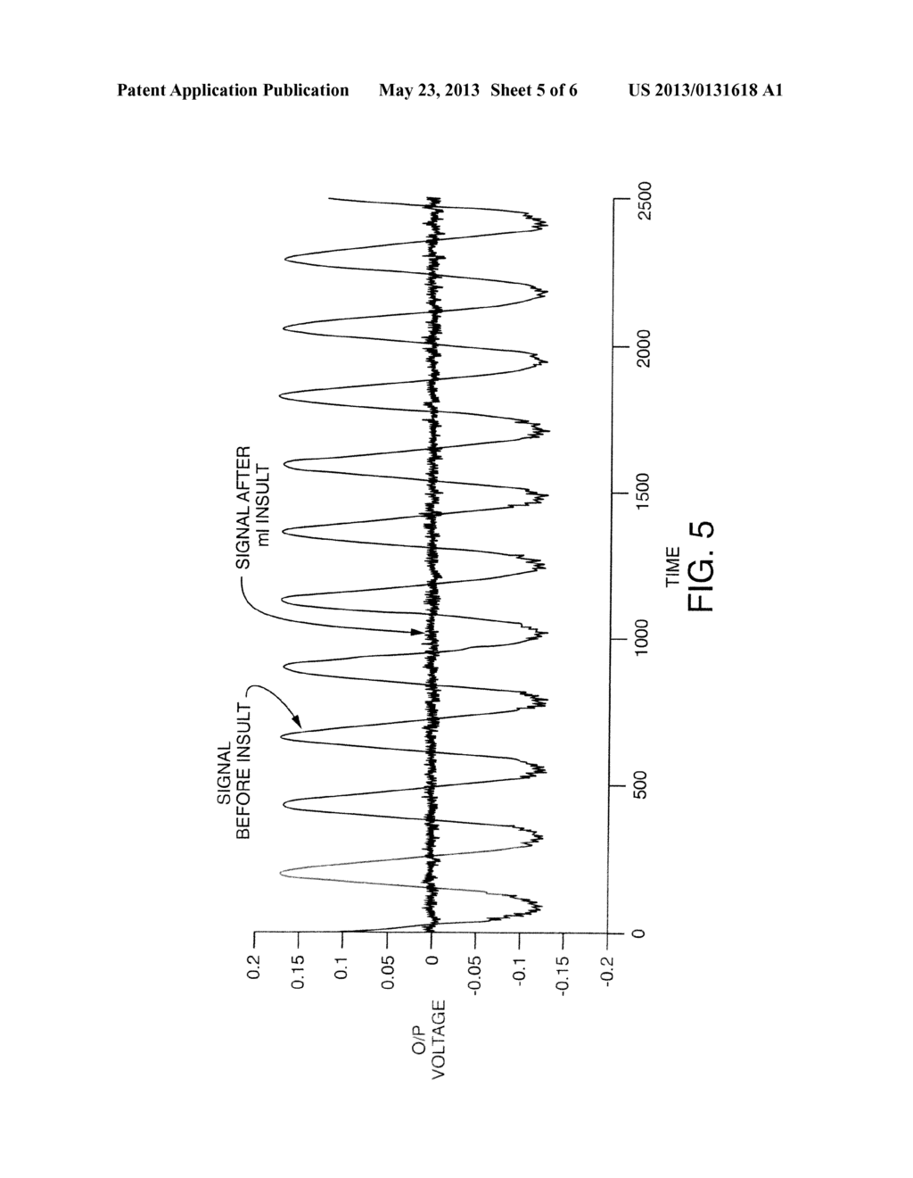 Contactless Passive Sensing For Absorbent Articles - diagram, schematic, and image 06