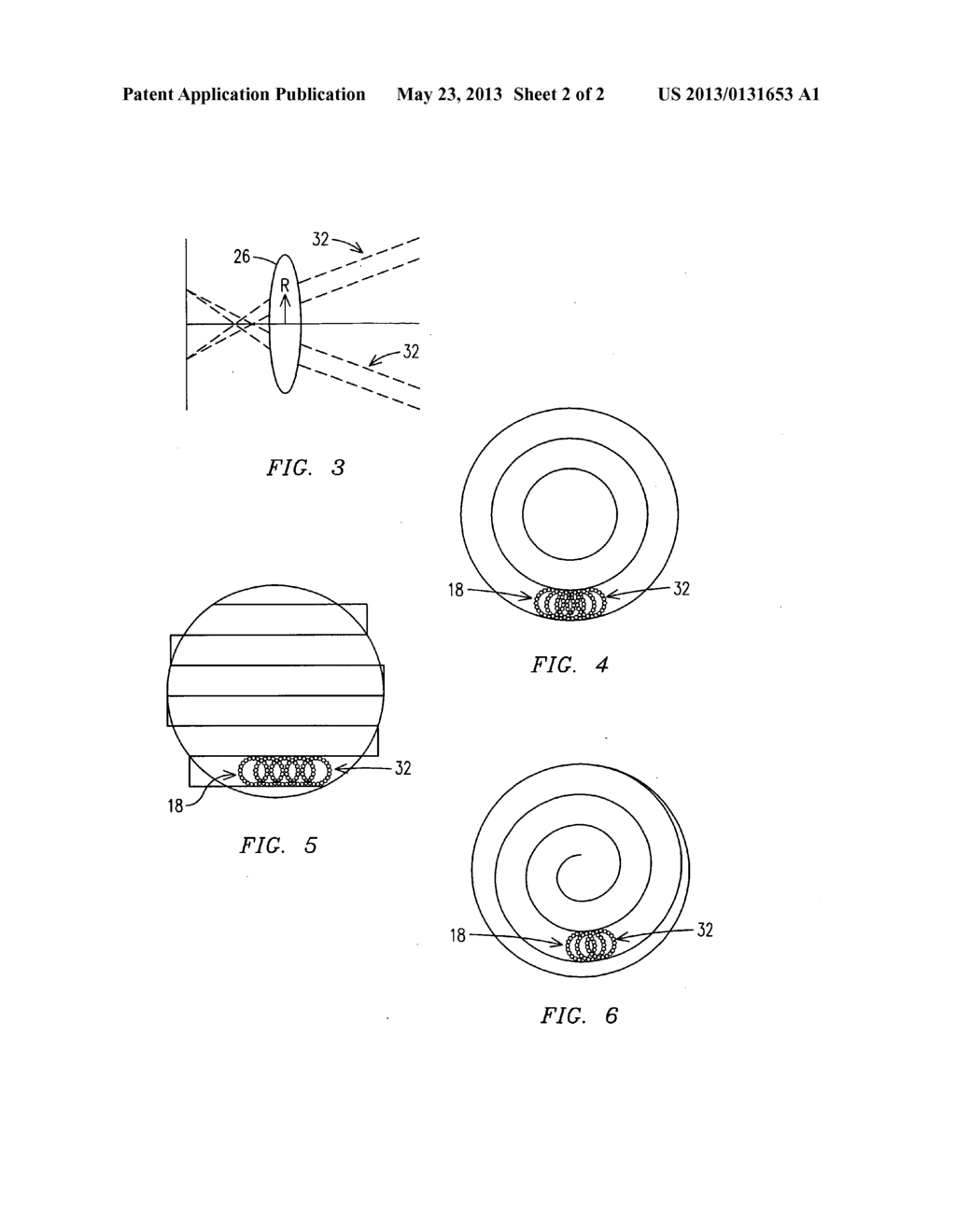 Ophthalmological laser method and apparatus - diagram, schematic, and image 03