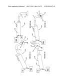 VACUUM COAGULATION PROBES diagram and image