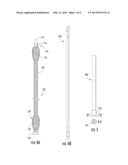 THREADED ELASTIC INTRAMEDULLARY NAILS DEVICES AND METHODS diagram and image