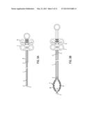 TWO-STAGE SNARE-BASKET MEDICAL DEVICE diagram and image