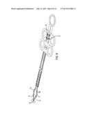 TWO-STAGE SNARE-BASKET MEDICAL DEVICE diagram and image