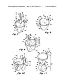 SURGICAL RETRIEVAL APPARATUS diagram and image