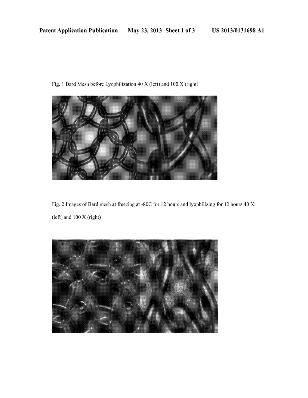 Antimicrobial Coating for Surgical Implants and Method of Manufacturing - diagram, schematic, and image 02