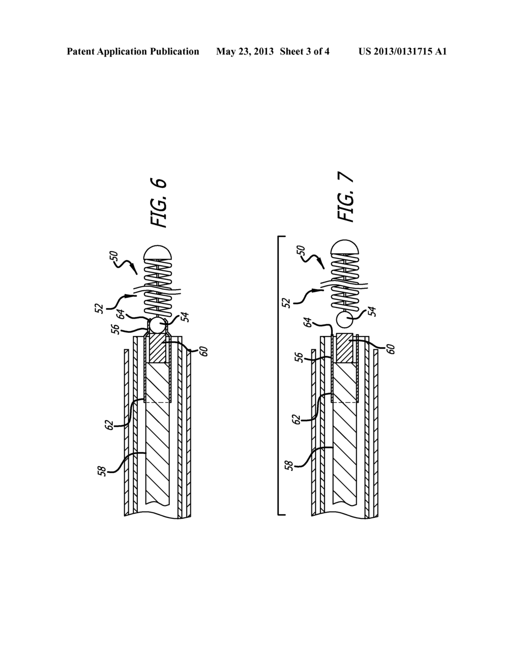 STRETCH RESISTANT THERAPEUTIC DEVICE - diagram, schematic, and image 04