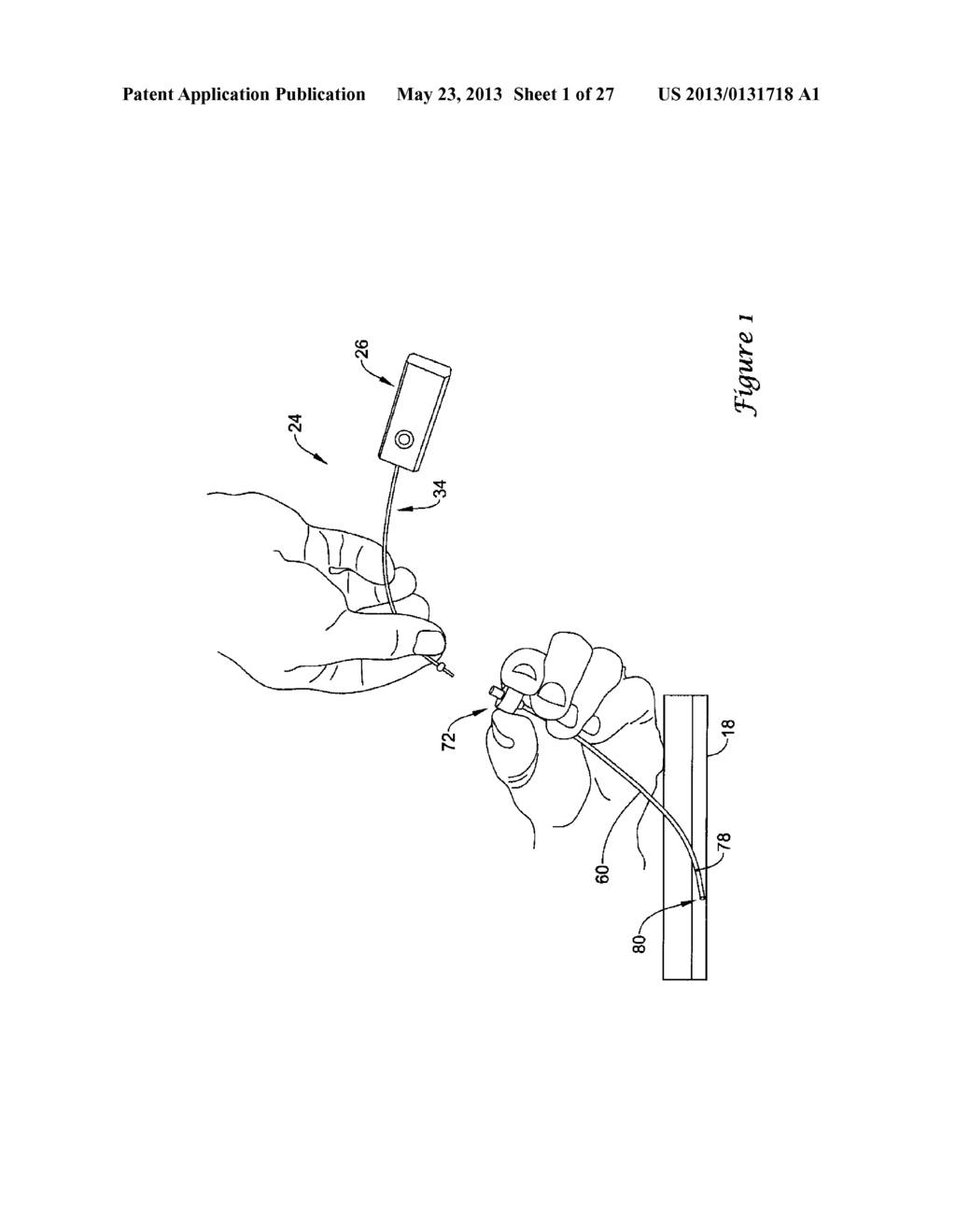 EXPANDABLE DEVICE SHEATH FOR VASCULAR CLOSURE PLUG DEPLOYMENT - diagram, schematic, and image 02