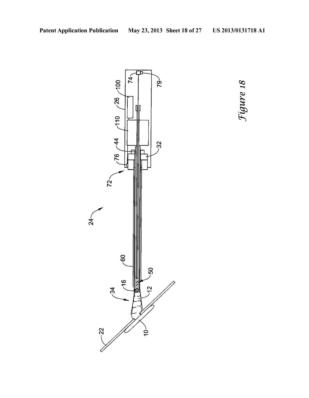 EXPANDABLE DEVICE SHEATH FOR VASCULAR CLOSURE PLUG DEPLOYMENT - diagram, schematic, and image 19