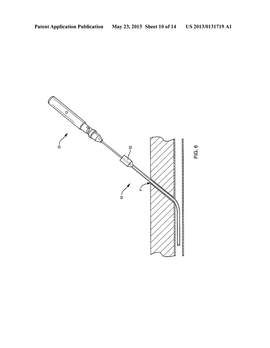 WOUND CLOSURE DEVICES AND SYSTEMS - diagram, schematic, and image 11