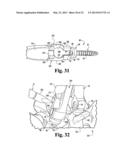 SYSTEMS AND METHODS FOR SPINAL STABILIZATION WITH FLEXIBLE ELEMENTS diagram and image