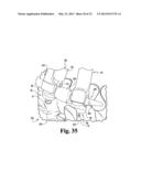 SYSTEMS AND METHODS FOR SPINAL STABILIZATION WITH FLEXIBLE ELEMENTS diagram and image