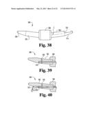 SYSTEMS AND METHODS FOR SPINAL STABILIZATION WITH FLEXIBLE ELEMENTS diagram and image