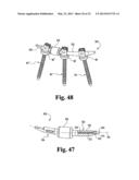 SYSTEMS AND METHODS FOR SPINAL STABILIZATION WITH FLEXIBLE ELEMENTS diagram and image