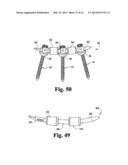 SYSTEMS AND METHODS FOR SPINAL STABILIZATION WITH FLEXIBLE ELEMENTS diagram and image