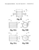 SYSTEMS AND METHODS FOR SPINAL STABILIZATION WITH FLEXIBLE ELEMENTS diagram and image