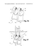 SYSTEMS AND METHODS FOR SPINAL STABILIZATION WITH FLEXIBLE ELEMENTS diagram and image