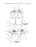 SYSTEMS AND METHODS FOR SPINAL STABILIZATION WITH FLEXIBLE ELEMENTS diagram and image