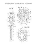 Polyaxial bone anchor with articulating retainer and multi-start closure diagram and image