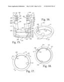 Polyaxial bone anchor with articulating retainer and multi-start closure diagram and image