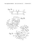 Polyaxial bone anchor with articulating retainer and multi-start closure diagram and image