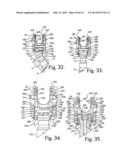 Polyaxial bone anchor with articulating retainer and multi-start closure diagram and image