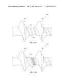 BONE SCREW AND METHOD FOR MANUFACTURING THE SAME diagram and image