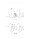 BONE SCREW AND METHOD FOR MANUFACTURING THE SAME diagram and image