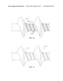 BONE SCREW AND METHOD FOR MANUFACTURING THE SAME diagram and image