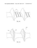 BONE SCREW AND METHOD FOR MANUFACTURING THE SAME diagram and image