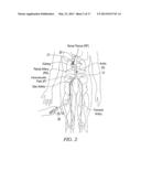 Endovascular Nerve Monitoring Devices and Associated Systems and Methods diagram and image