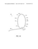 Endovascular Nerve Monitoring Devices and Associated Systems and Methods diagram and image