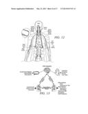 Endovascular Nerve Monitoring Devices and Associated Systems and Methods diagram and image