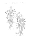 Endovascular Nerve Monitoring Devices and Associated Systems and Methods diagram and image