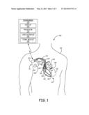 APPARATUS AND METHOD FOR SELECTING A PREFERRED PACING VECTOR IN A CARDIAC     RESYNCHRONIZATION DEVICE diagram and image