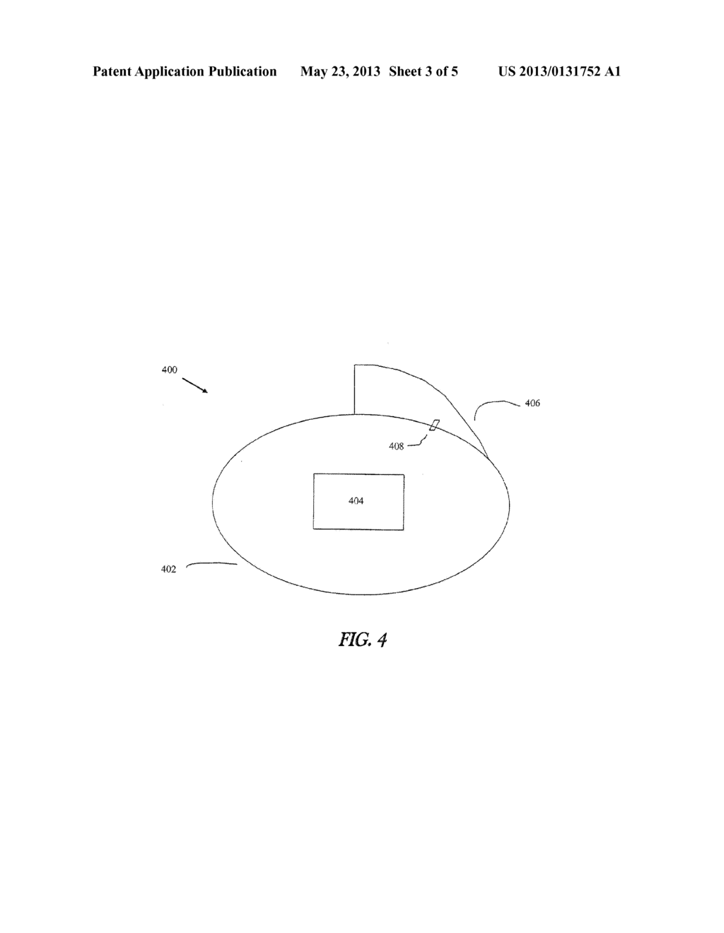 IMPLANTABLE MEDICAL DEVICE WITH FRACTAL ANTENNA - diagram, schematic, and image 04