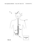 PATIENT DIRECTED THERAPY CONTROL diagram and image