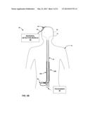 PATIENT DIRECTED THERAPY CONTROL diagram and image