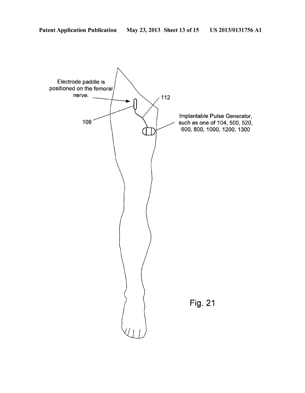 Posterior Tibial-Nerve and/or Other Nerve Stimulation System and Method - diagram, schematic, and image 14