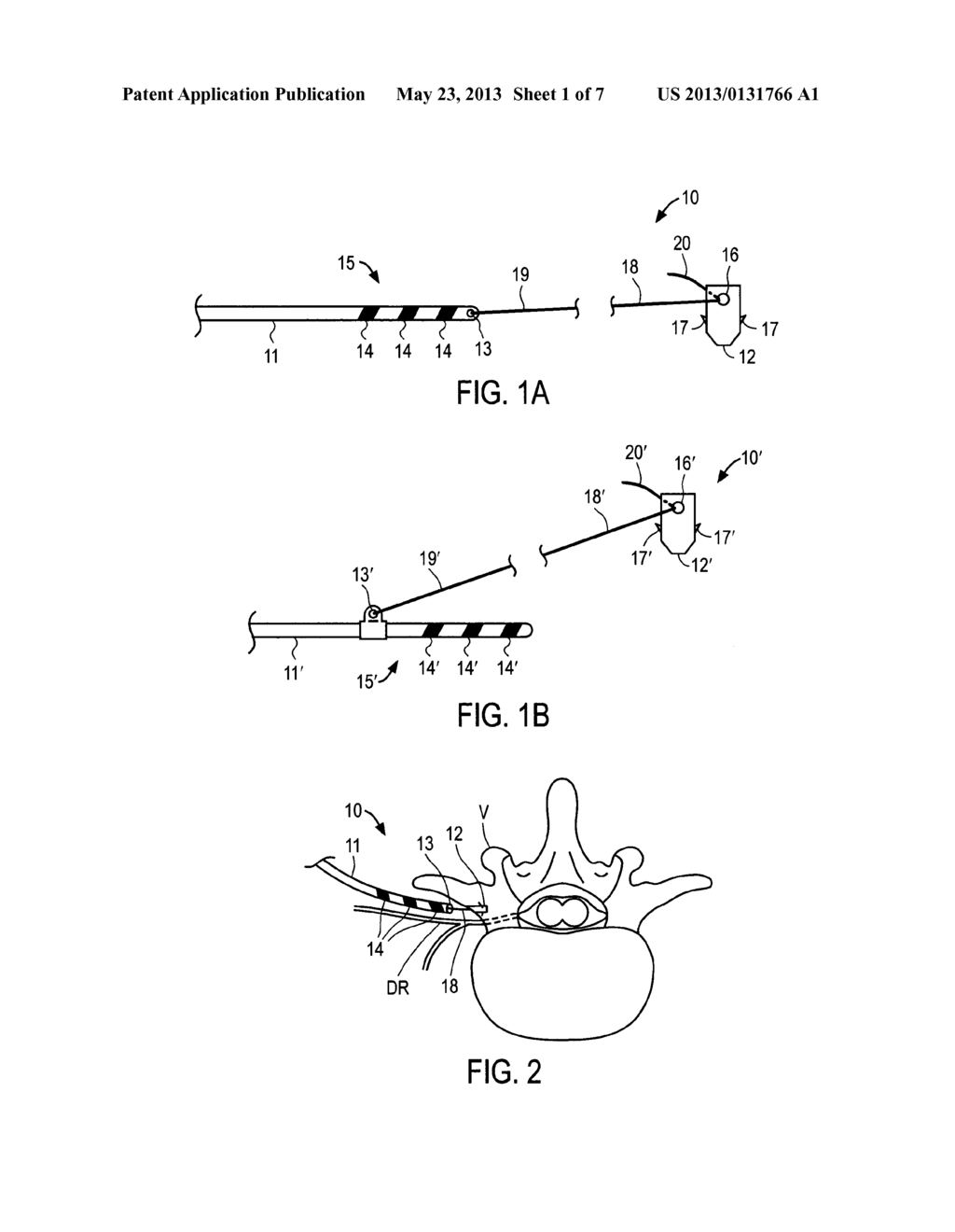 APPARATUS AND METHODS FOR ANCHORING ELECTRODE LEADS FOR USE WITH     IMPLANTABLE NEUROMUSCULAR ELECTRICAL STIMULATOR - diagram, schematic, and image 02