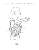 ELECTRICAL STIMULATION OF THE SYMPATHETIC NERVE CHAIN diagram and image