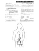 DEVICE AND METHOD FOR ESTABLISHING AN ARTIFICIAL ARTERIO-VENOUS FISTULA diagram and image