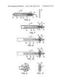 DEVICE AND METHOD FOR ESTABLISHING AN ARTIFICIAL ARTERIO-VENOUS FISTULA diagram and image